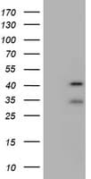 Monoclonal Mouse anti-Human USP12 Antibody (clone OTI1E3, aa61-251, WB)