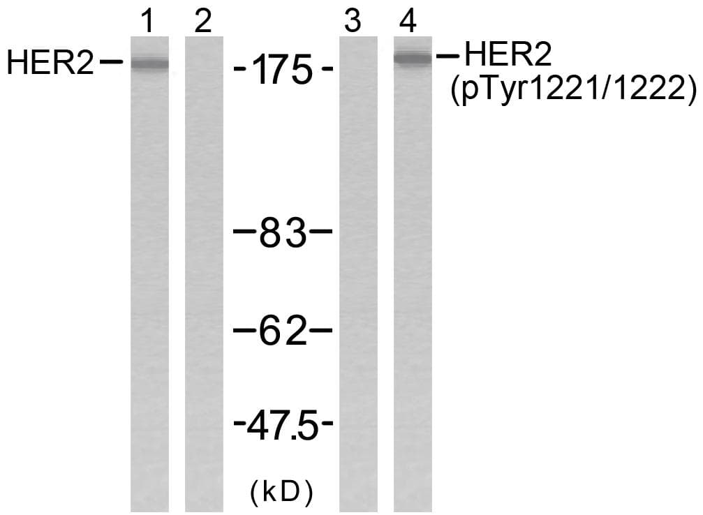 ERBB2 / HER2 Antibody