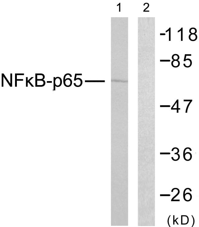 RELA / NFKB p65 Antibody (p254)
