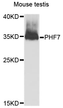 PHF7 Antibody