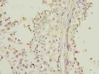 LRRC20 Antibody