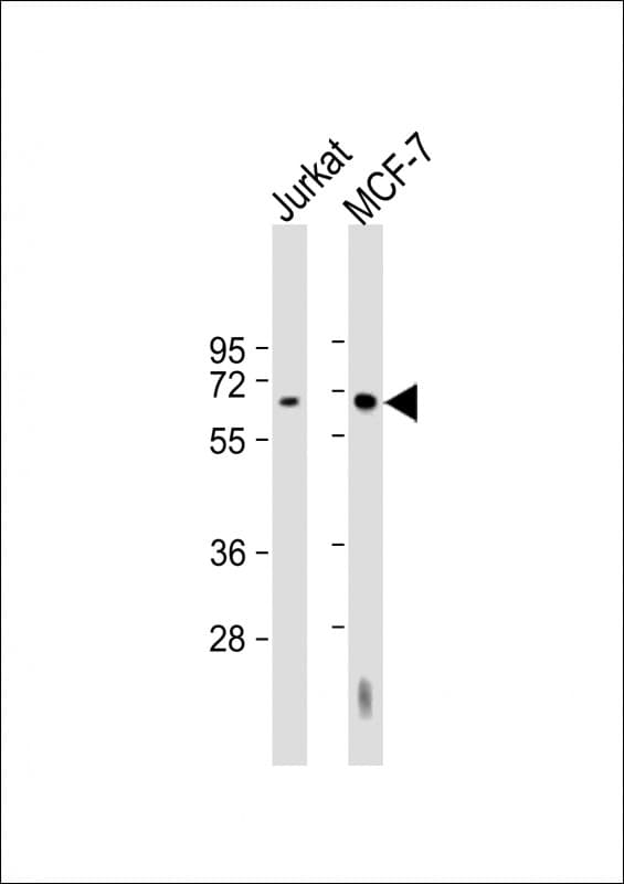 HEXB Antibody (aa170-203)