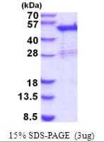 Human SNX5 Protein (Recombinant His)