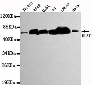 DLAT / PDC-E2 Antibody