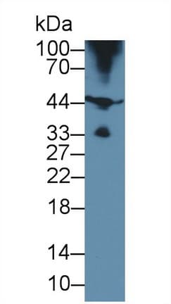 HFE2 / Hemojuvelin Antibody (APC)