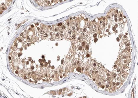 GPRASP1 / GASP-1 Antibody