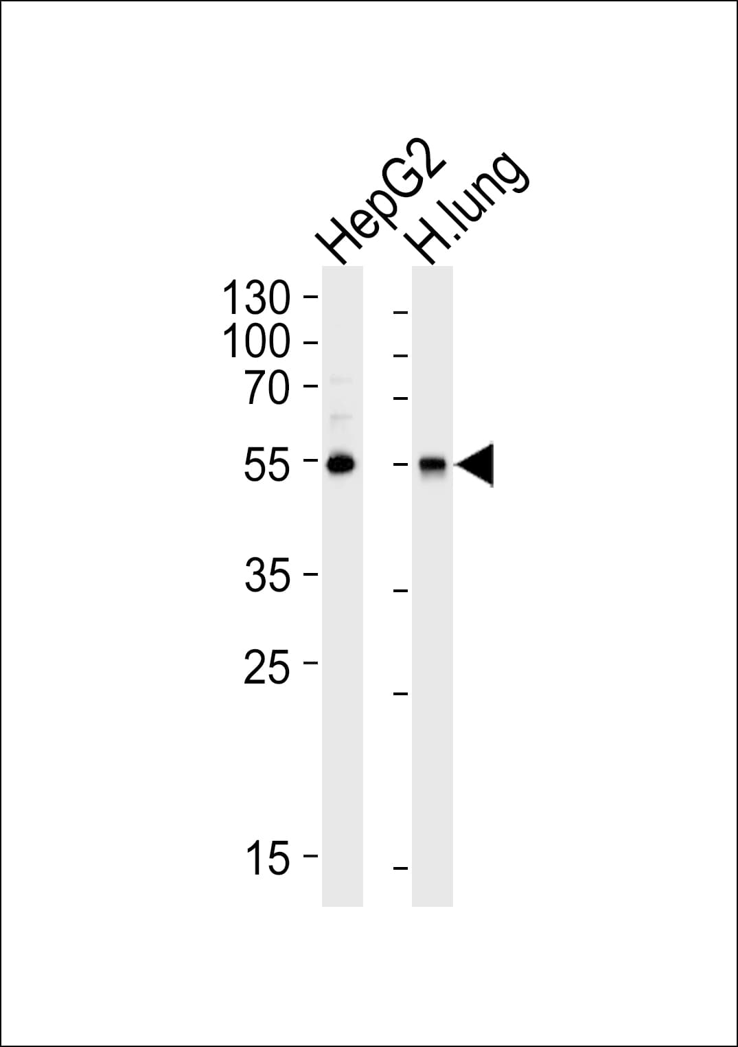 ALDH1A1 / ALDH1 Antibody