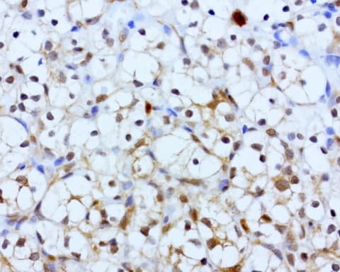 Monoclonal Mouse anti-Human BID Antibody (clone UMAB139, IHC, WB)