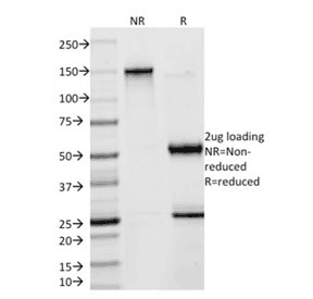 SOX9 Antibody (clone SOX9/2398, Ready-to-Use)