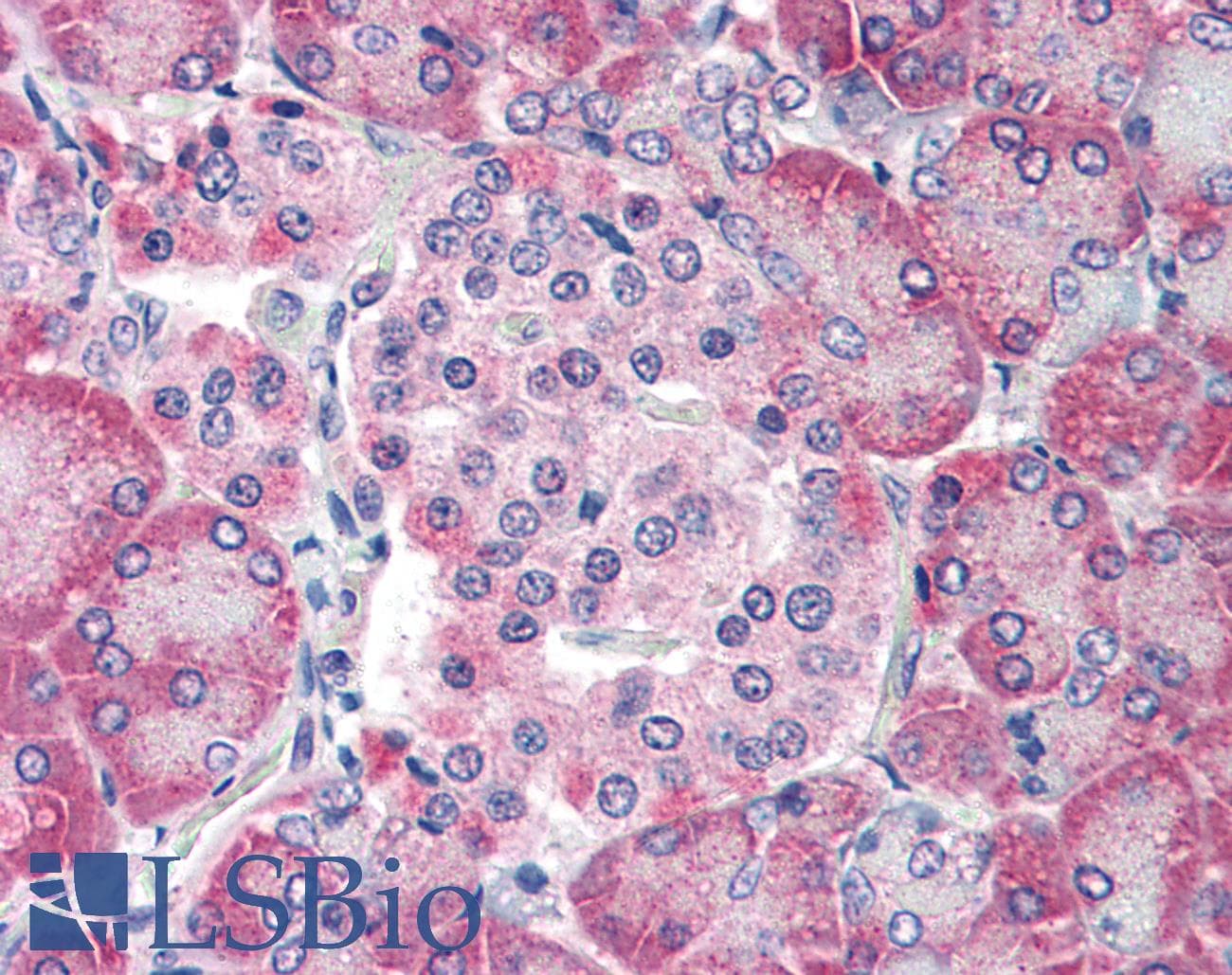 IHC-plus™ Polyclonal Rabbit anti-Human TM9SF4 Antibody (N-Terminus)