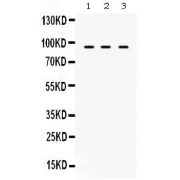 ABCB2 / TAP1 Antibody (aa438-471)