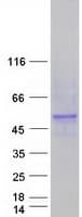 Human CYP4F22 Protein (Recombinant Myc-DDK (Flag))