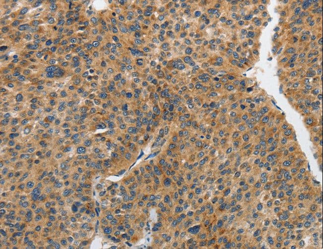 PIP5K1C Antibody