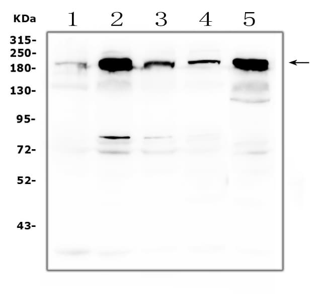ITGB4 / Integrin Beta 4 Antibody (aa28-266)