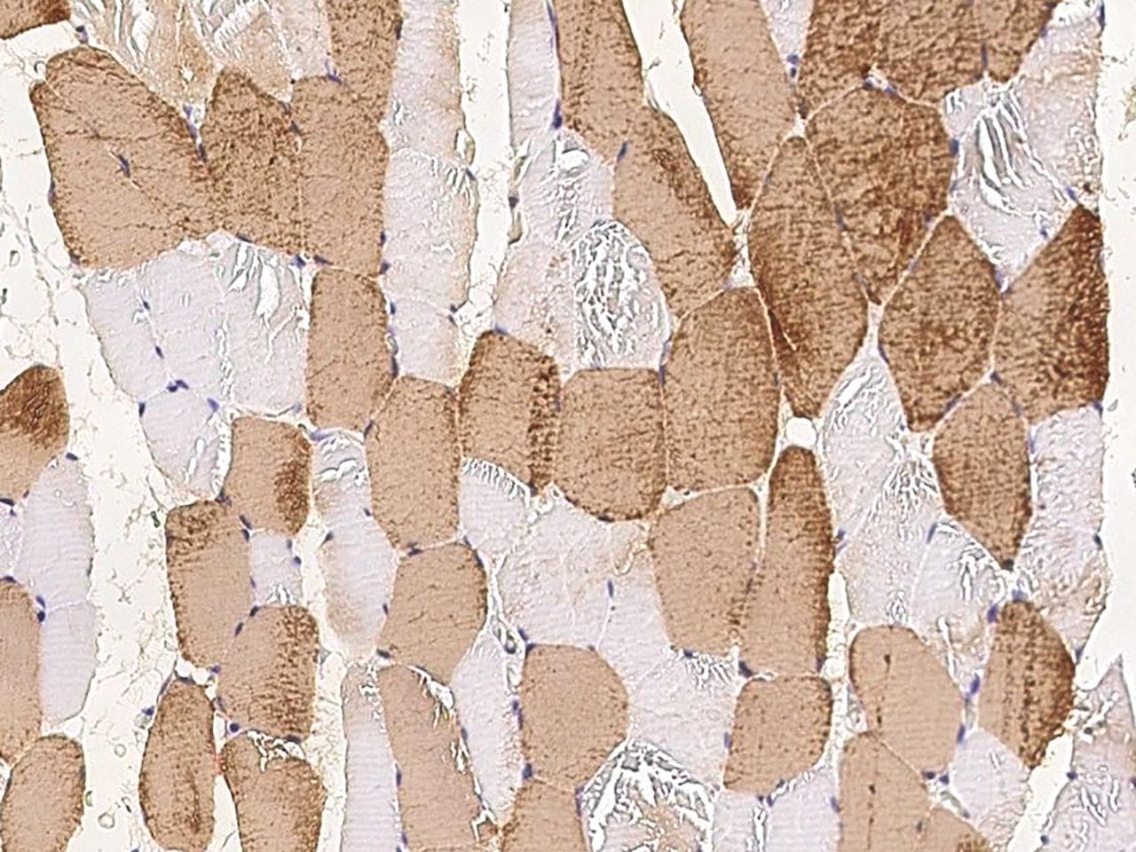Polyclonal Rabbit anti-Human MYL3 Antibody (IHC)