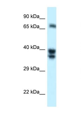 Polyclonal Rabbit anti-Human SH3BP1 Antibody (aa125-174, WB)
