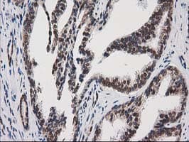 PRKCE / PKC-Epsilon Antibody (clone OTI1B4)