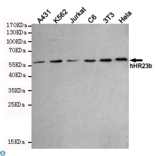 RAD23B / HR23B Antibody