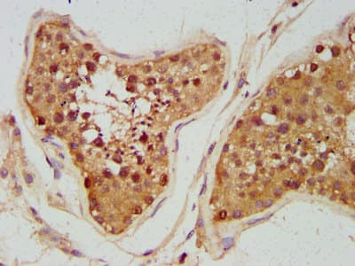 UNC5H2 / UNC5B Antibody