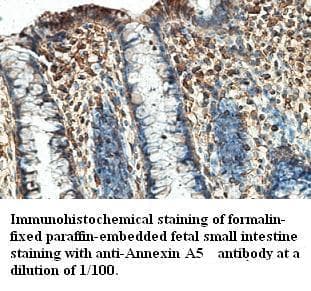 Polyclonal Rabbit anti-Human ANXA5 / Annexin V Antibody (IHC, WB)