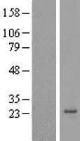 ANAPC11 / APC11 Protein (Over-Expression Lysate Myc-DDK (Flag))