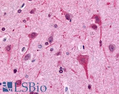 IHC-plus™ Polyclonal Rabbit anti-Human GPR75 Antibody (C-Terminus, IHC)