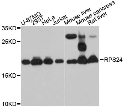 Polyclonal Rabbit anti-Human RPS24 / Ribosomal Protein S24 Antibody (WB)