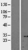Human SDCBP2 / Syntenin 2 Protein (Over-Expression Lysate Myc-DDK (Flag))
