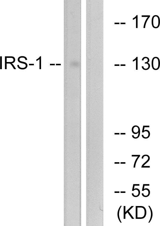 Polyclonal Rabbit anti-Human IRS1 Antibody (p312, IHC, IF, WB)