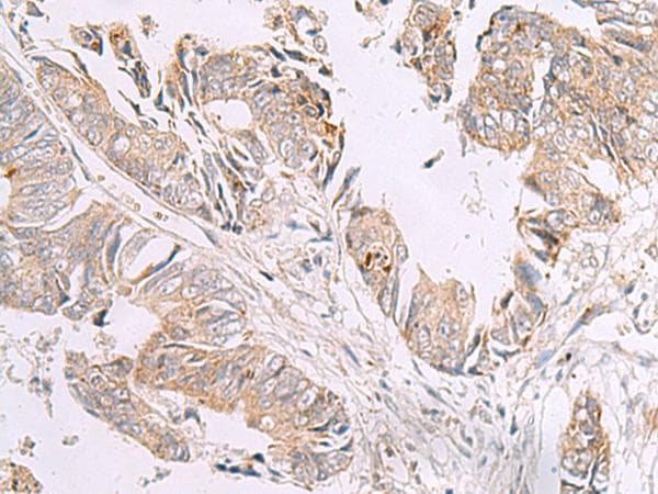 Polyclonal Rabbit anti-Human GIMAP2 Antibody (IHC)