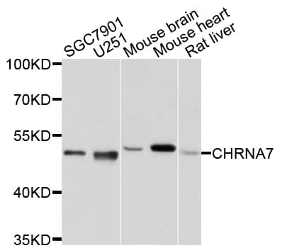 Polyclonal Rabbit anti-Human CHRNA7 Antibody (IHC, WB)