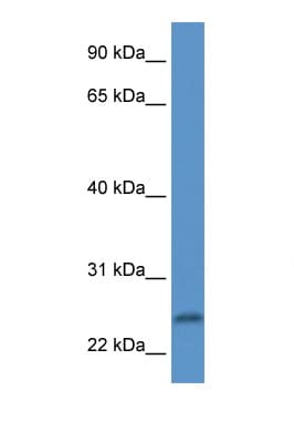 Polyclonal Rabbit anti-Human PI15 Antibody (aa32-81, WB)