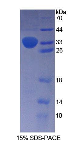 Human Proenkephalin / PENK Protein (Recombinant His-T7)