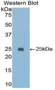 IGFBP7 / TAF Antibody (aa88-281)