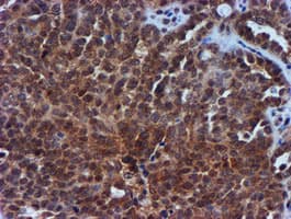 TIMP2 Antibody (clone OTI1A6, Carrier-free)