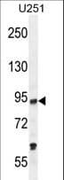 KAT2B / PCAF Antibody (aa802-832)
