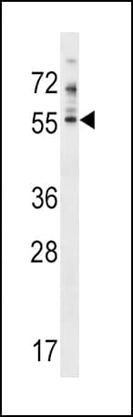 Polyclonal Rabbit anti-Human PDE7A Antibody (aa66-94, WB)