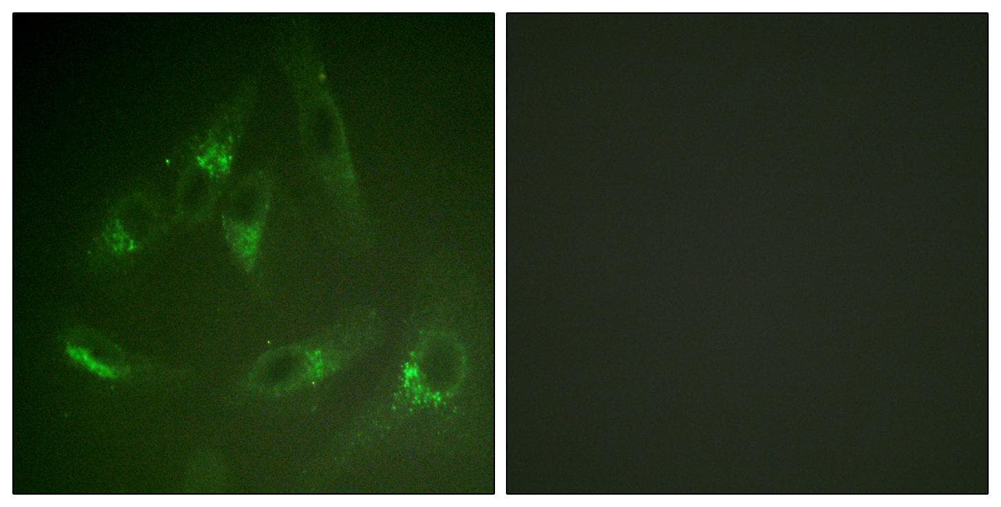 CSF1R / CD115 / FMS Antibody (Ab-561)