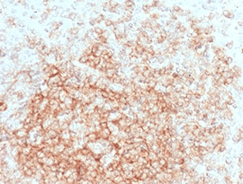 Monoclonal Mouse anti-Human CR2 / CD21 Antibody (clone CDLA21-1, IHC)
