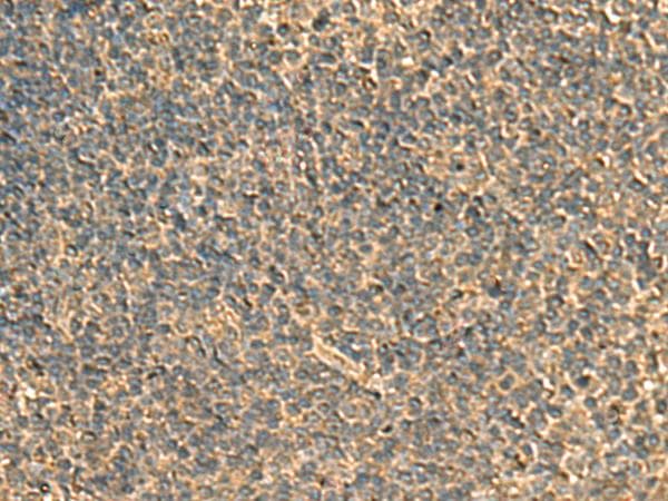 RPS11 / Ribosomal Protein 11 Antibody