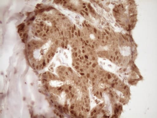 Monoclonal Mouse anti-Human GFI1 Antibody (clone OTI6E8, aa1-180, IHC, WB)