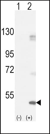 Polyclonal Rabbit anti-Human FGFR1 / FGF Receptor 1 Antibody (Tyr154, WB)