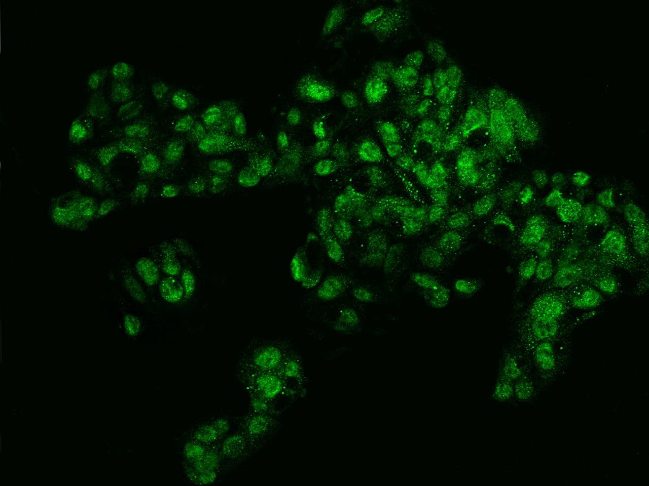 Polyclonal Rabbit anti-Human SELP / P-Selectin / CD62P Antibody (IF)