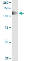 PTK2B / PYK2 Antibody (clone 1F9)