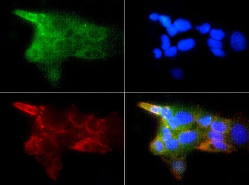 IGF1R / IGF1 Receptor Antibody