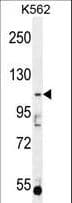 Polyclonal Rabbit anti-Human AGBL5 Antibody (aa99-127, IHC, IF, WB)