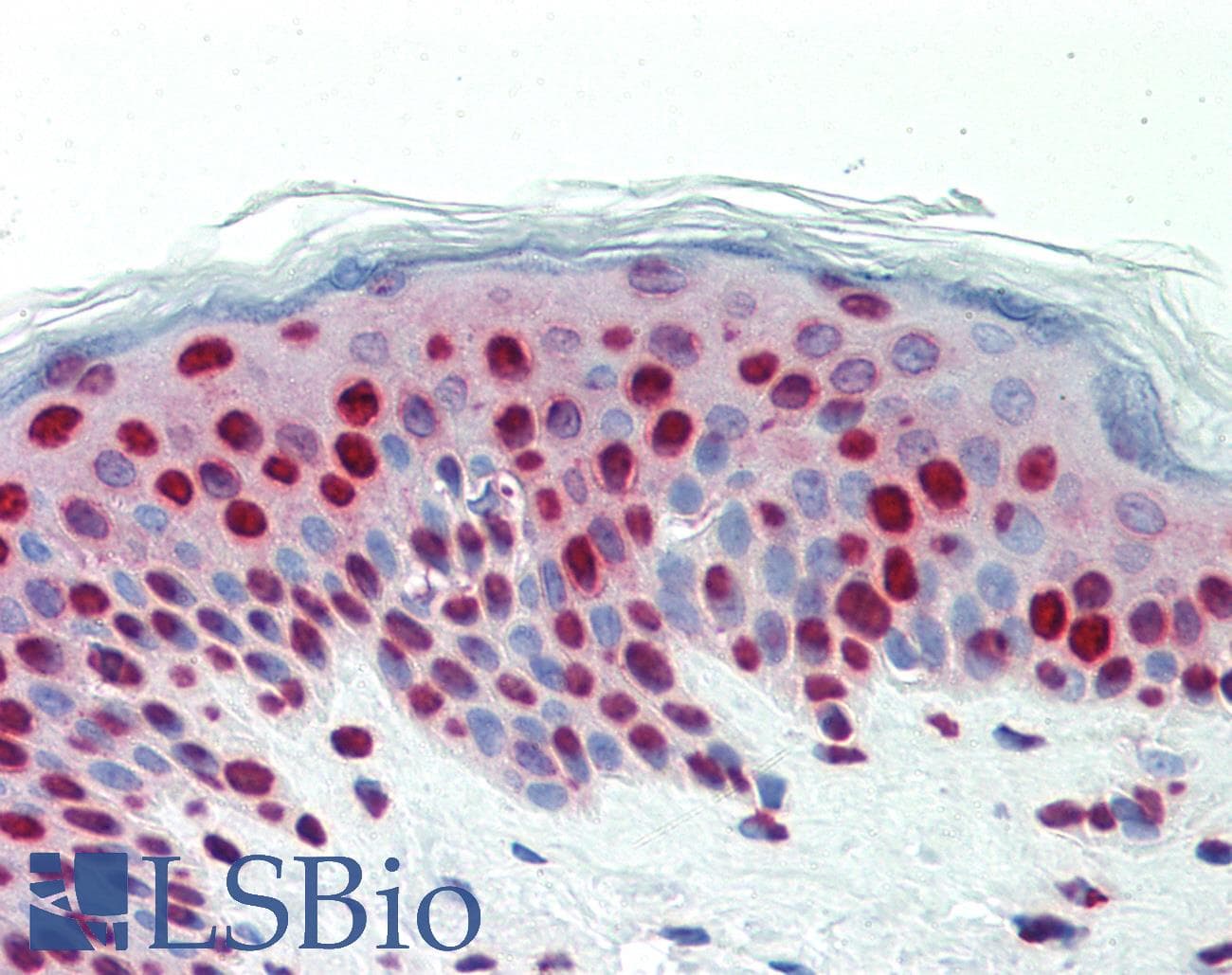 IHC-plus™ Polyclonal Rabbit anti-Human DCLRE1C / Artemis Antibody (aa21-50, IHC, WB)