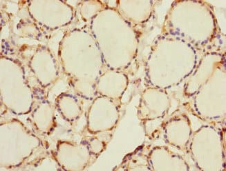RHOBTB1 Antibody