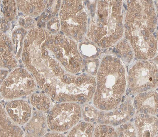MMP3 Antibody