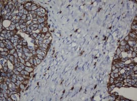 CDH1 / E Cadherin Antibody (clone OTI1B11)